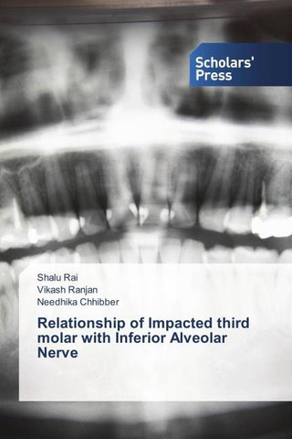 Relationship of Impacted third molar with Inferior Alveolar Nerve