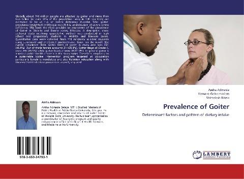 Prevalence of Goiter