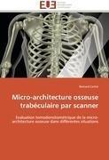 Micro-architecture osseuse trabéculaire par scanner