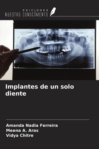 Implantes de un solo diente