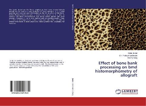 Effect of bone bank processing on bmd histomorphometry of allograft