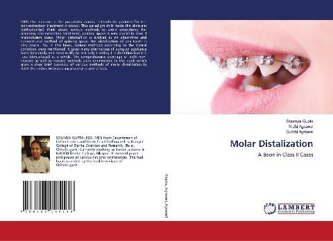 Molar Distalization