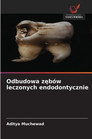 Odbudowa z¿bów leczonych endodontycznie