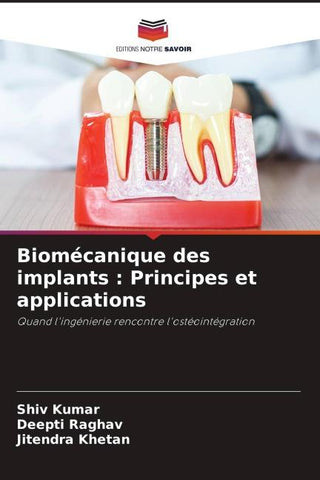 Biomécanique des implants : Principes et applications