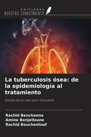 La tuberculosis ósea: de la epidemiología al tratamiento