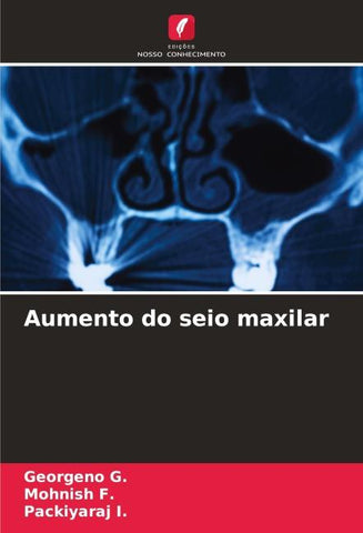 Aumento do seio maxilar