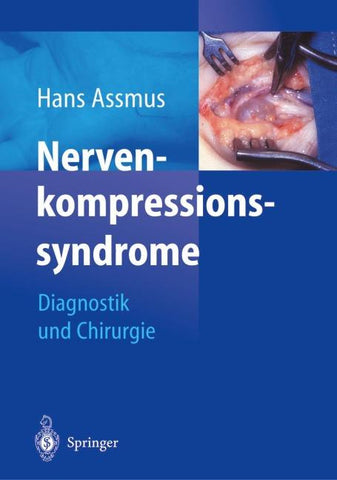 Nerven-kompressions-syndrome