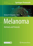 Melanoma