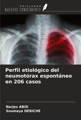 Perfil etiológico del neumotórax espontáneo en 206 casos