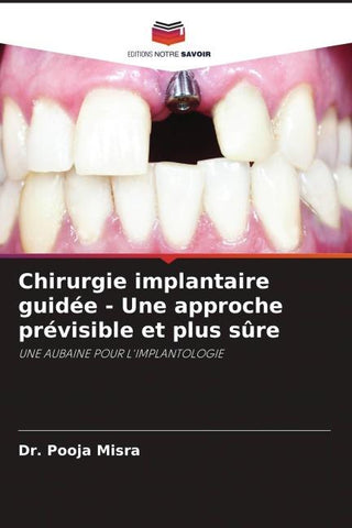 Chirurgie implantaire guidée - Une approche prévisible et plus sûre