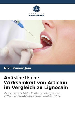 Anästhetische Wirksamkeit von Articain im Vergleich zu Lignocain