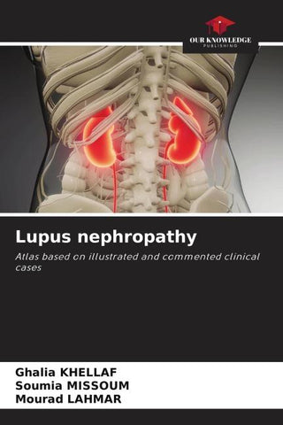Lupus nephropathy