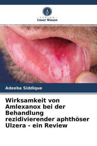 Wirksamkeit von Amlexanox bei der Behandlung rezidivierender aphthöser Ulzera - ein Review