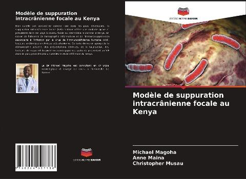Modèle de suppuration intracrânienne focale au Kenya