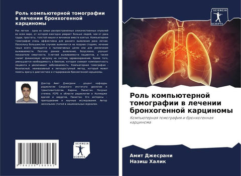 Rol' komp'üternoj tomografii w lechenii bronhogennoj karcinomy