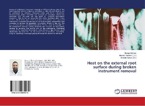 Heat on the external root surface during broken instrument removal