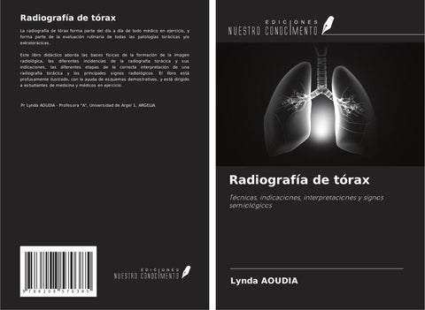 Radiografía de tórax