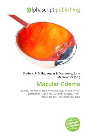 Macular Edema