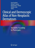 Clinical and Dermoscopic Atlas of Non-Neoplastic Dermatoses