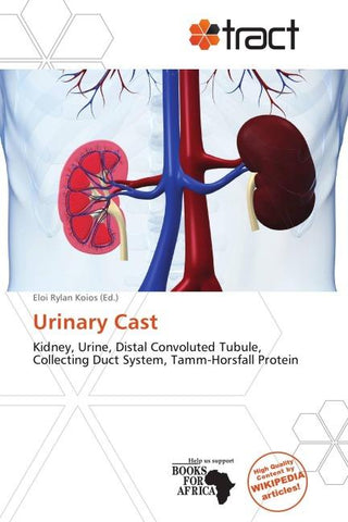 Urinary Cast
