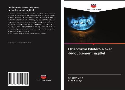 Ostéotomie bilatérale avec dédoublement sagittal