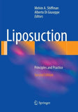 Liposuction