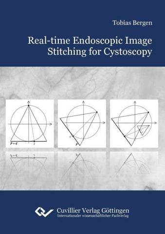 Real-time Endoscopic Image Stitching for Cystoscopy