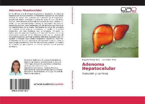 Adenoma Hepatocelular