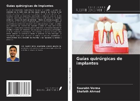 Guías quirúrgicas de implantes