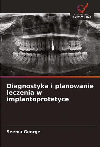 Diagnostyka i planowanie leczenia w implantoprotetyce