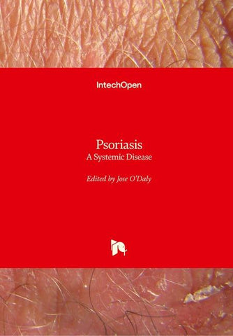 Psoriasis