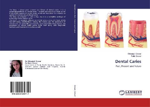 Dental Caries