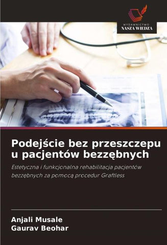 Podej¿cie bez przeszczepu u pacjentów bezz¿bnych