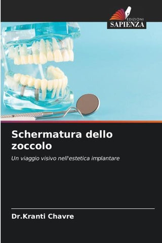Schermatura dello zoccolo