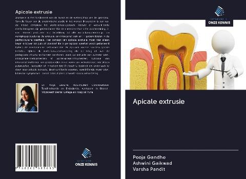 Apicale extrusie