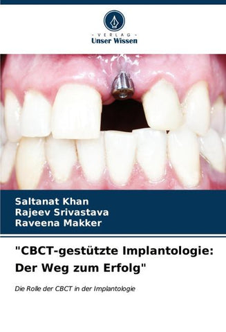 "CBCT-gestützte Implantologie: Der Weg zum Erfolg"