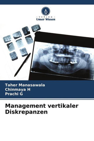 Management vertikaler Diskrepanzen