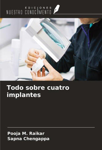 Todo sobre cuatro implantes
