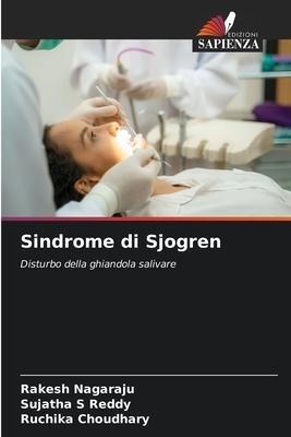 Sindrome di Sjogren