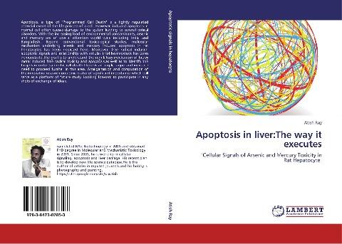 Apoptosis in liver:The way it executes