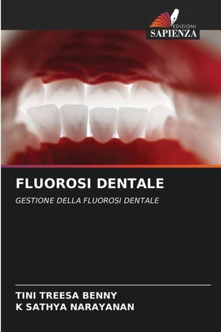 FLUOROSI DENTALE