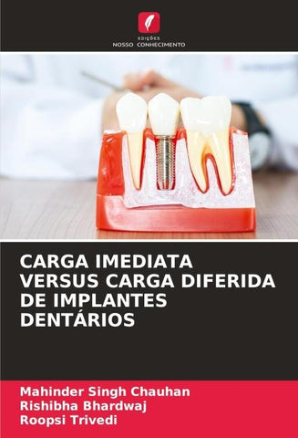 CARGA IMEDIATA VERSUS CARGA DIFERIDA DE IMPLANTES DENTÁRIOS