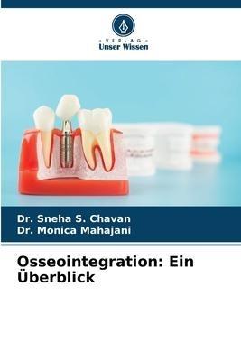 Osseointegration: Ein Überblick