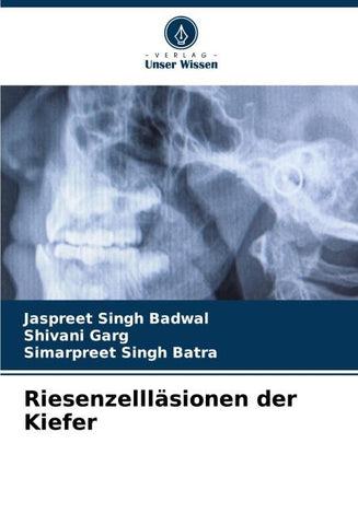 Riesenzellläsionen der Kiefer