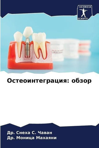 Osteointegraciq: obzor