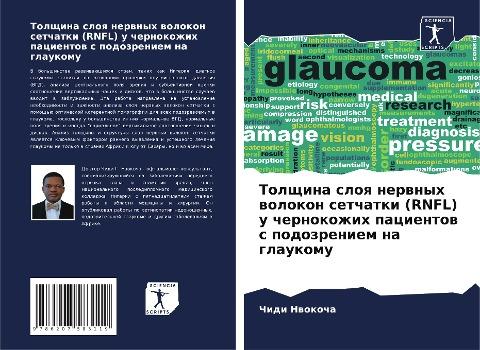 Tolschina sloq nerwnyh wolokon setchatki (RNFL) u chernokozhih pacientow s podozreniem na glaukomu
