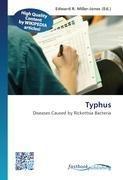 Typhus