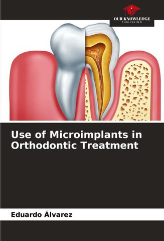 Use of Microimplants in Orthodontic Treatment