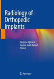 Radiology of Orthopedic Implants