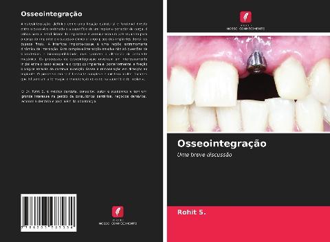 Osseointegração